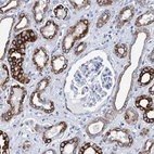 Immunohistochemical staining of human kidney shows strong cytoplasmic positivity in cells in tubules.