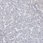 Immunohistochemical staining of human liver shows low positivity in hepatocytes as expected.