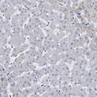 Immunohistochemical staining of human liver shows low positivity in hepatocytes as expected.