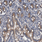 Anti-MAMDC2 Antibody