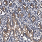 Anti-MAMDC2 Antibody