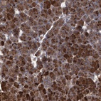 Anti-ABCF2 Antibody