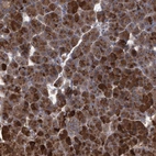 Anti-ABCF2 Antibody
