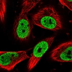 Immunofluorescent staining of human cell line U-251 MG shows localization to nucleoplasm.