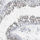 Immunohistochemical staining of human testis shows high expression.