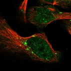 Immunofluorescent staining of human cell line U-2 OS shows localization to nucleoplasm & vesicles.