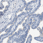 Anti-NAT9 Antibody