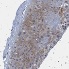 Immunohistochemical staining of human placenta shows moderate cytoplasmic/membranous positivity in decidual cells.