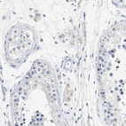 Immunohistochemical staining of human testis shows weak cytoplasmic positivity in Leydig cells.