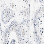 Immunohistochemical staining of human testis shows weak cytoplasmic positivity in Leydig cells.