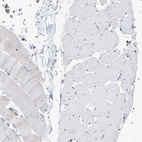 Immunohistochemical staining of human skeletal muscle shows no positivity in a myocytes as expected.