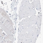 Immunohistochemical staining of human skeletal muscle shows no positivity in a myocytes as expected.