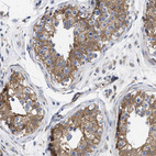 Immunohistochemical staining of human testis shows strong cytoplasmic positivity in cells in seminiferous ducts.