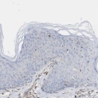 Immunohistochemical staining of human skin shows no cytoplasmic positivity in squamous epithelial cells as expected.