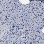 Immunohistochemical staining of human pancreas shows no cytoplasmic positivity in exocrine glandular cells as expected.