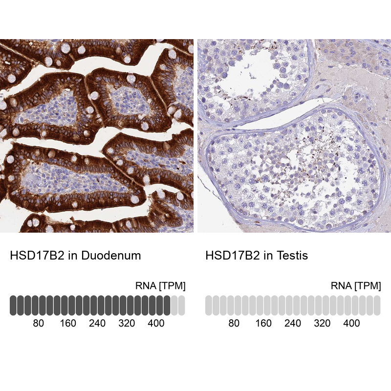 Anti-HSD17B2 Antibody