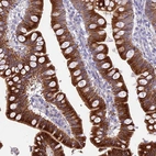 Immunohistochemical staining of human small intestine shows moderate to strong cytoplasmic positivity in glandular cells.