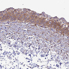 Immunohistochemical staining of human urinary bladder shows moderate to strong cytoplasmic positivity in urothelial cells.