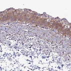 Immunohistochemical staining of human urinary bladder shows moderate to strong cytoplasmic positivity in urothelial cells.