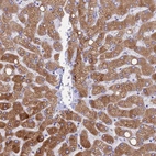 Immunohistochemical staining of human liver shows moderate to strong cytoplasmic positivity in hepatocytes.