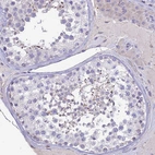 Immunohistochemical staining of human testis shows no positivity in cells in seminiferous ducts as expected.