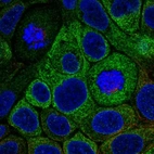 Immunofluorescent staining of human cell line RT4 shows localization to endoplasmic reticulum.