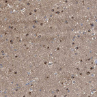 Anti-FHOD3 Antibody