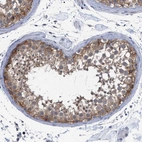 Immunohistochemical staining of human Testis shows moderate cytoplasmic positivity in cells in seminiferous ducts.