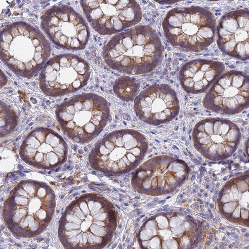 Anti-TTLL11 Antibody