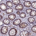 Anti-TTLL11 Antibody
