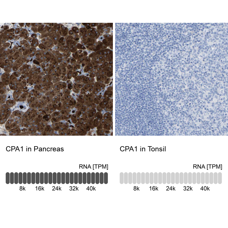 Anti-CPA1 Antibody