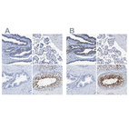 Immunohistochemical staining of human fallopian tube, placenta, prostate and testis using Anti-DNAI1 antibody HPA021843 (A) shows similar protein distribution across tissues to independent antibody HPA021649 (B).