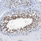 Immunohistochemical staining of human testis shows moderate cytoplasmic positivity in cells in seminiferous ducts.
