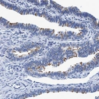 Immunohistochemical staining of human Fallopian tube shows moderate positivity in cilia in glandular cells.