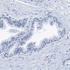 Immunohistochemical staining of human prostate shows no positivity in glandular cells as expected.