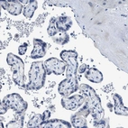Immunohistochemical staining of human placenta shows no positivity in trophoblastic cells as expected.