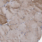 Immunohistochemical staining of human skeletal muscle shows moderate cytoplasmic positivity in myocytes.