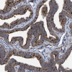 Immunohistochemical staining of human Fallopian tube shows moderate to strong cytoplasmic positivity in glandular cells.