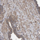 Immunohistochemical staining of human prostate shows moderate cytoplasmic positivity in smooth muscle cells.
