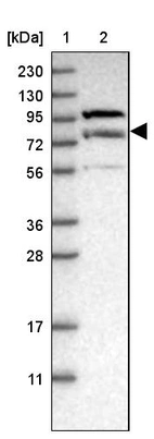 Lane 1: Marker [kDa] 230, 130, 95, 72, 56, 36, 28, 17, 11_br/_Lane 2: Human cell line RT-4
