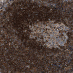 Anti-TPK1 Antibody