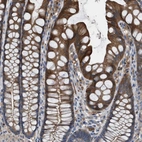 Immunohistochemical staining of human colon shows moderate to strong cytoplasmic positivity in glandular cells.