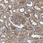 Immunohistochemical staining of human kidney shows weak to moderate cytoplasmic positivity in cells in tubules.