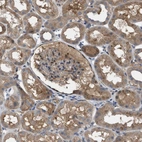 Immunohistochemical staining of human kidney shows weak to moderate cytoplasmic positivity in cells in tubules.