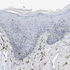 Immunohistochemical staining of human skin shows no positivity in squamous epithelial cells as expected.