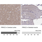 Anti-PRKCZ Antibody