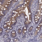 Immunohistochemical staining of human duodenum shows moderate cytoplasmic/ membranous positivity in glandular cells.