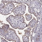 Immunohistochemical staining of human placenta shows weak cytoplasmic positivity in trophoblastic cells.