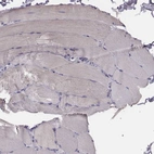 Immunohistochemical staining of human skeletal muscle shows no positivity in myocytes as expected.