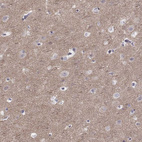 Immunohistochemical staining of human cerebral cortex shows moderate positivity in neuropil.